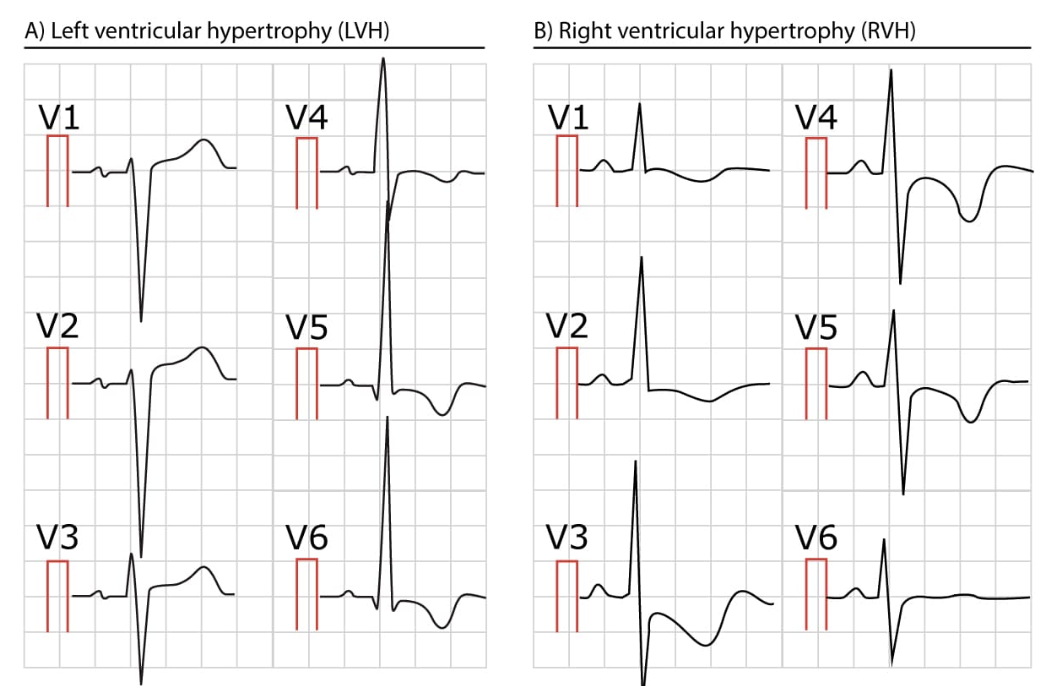 ECG Interpretation Made Simple – MOC Stepwise Approach